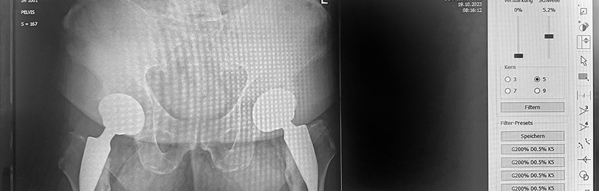 Röntgendiagnostik in Oberhausen Röntgendiagnostik in Oberhausen