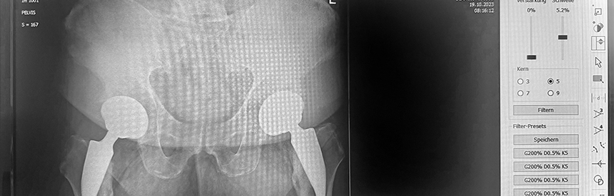 Röntgendiagnostik in Oberhausen